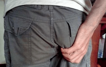 niežulys išangėje kaip parazitų buvimo simptomas