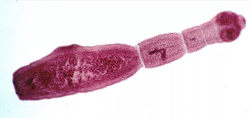 Echinococcus yra vienas iš pavojingiausių parazitų žmonėms