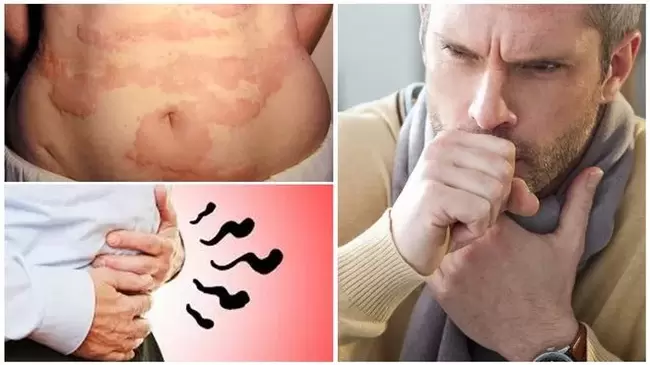 Alergija, kosulys ir pilvo pūtimas yra kirmėlių organizmo pažeidimo požymiai
