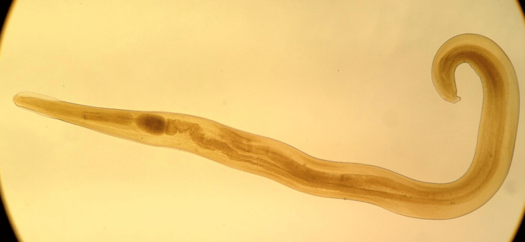 Pinworm yra dažnas parazitas tarp vaikų. 